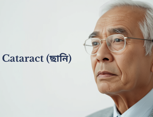 Cataract (ছানি): Early Signs, Causes & Treatment
