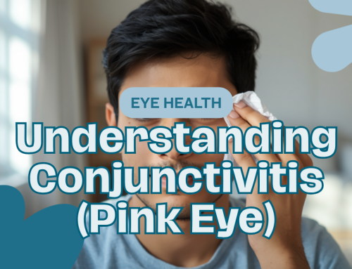Conjunctivitis (চোখ ওঠা): Causes, Symptoms & Care